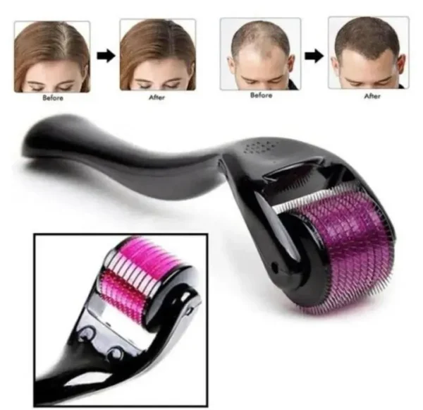 MZ1833200045BYWD-media-1 Anti-Hair Fall Derma Roller
